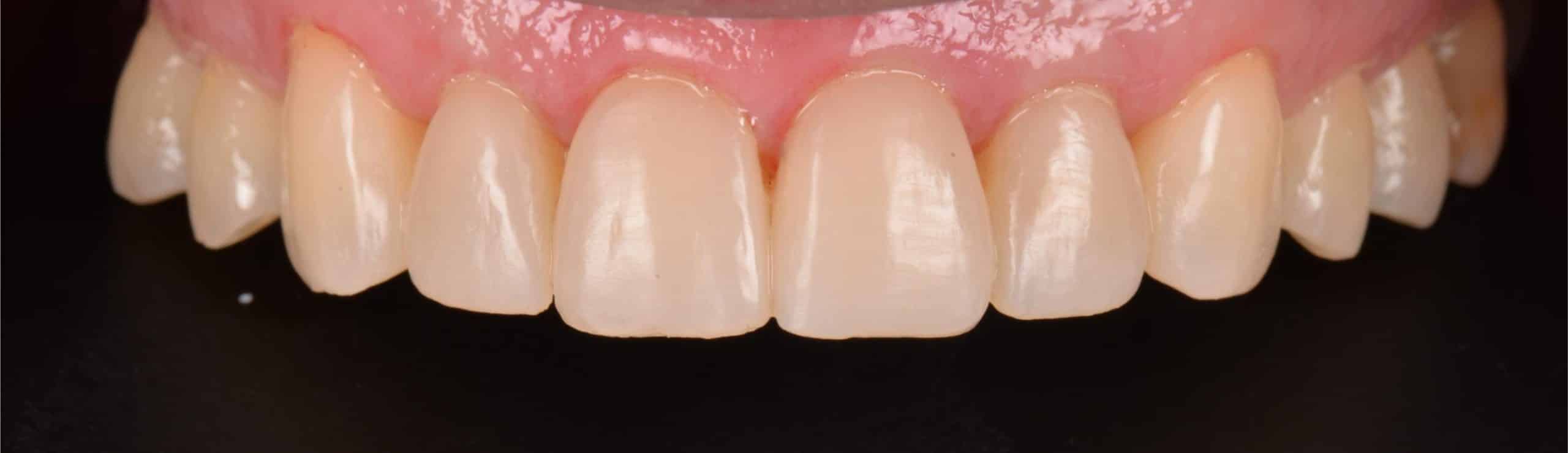 Clint - Close Up Transformation - After