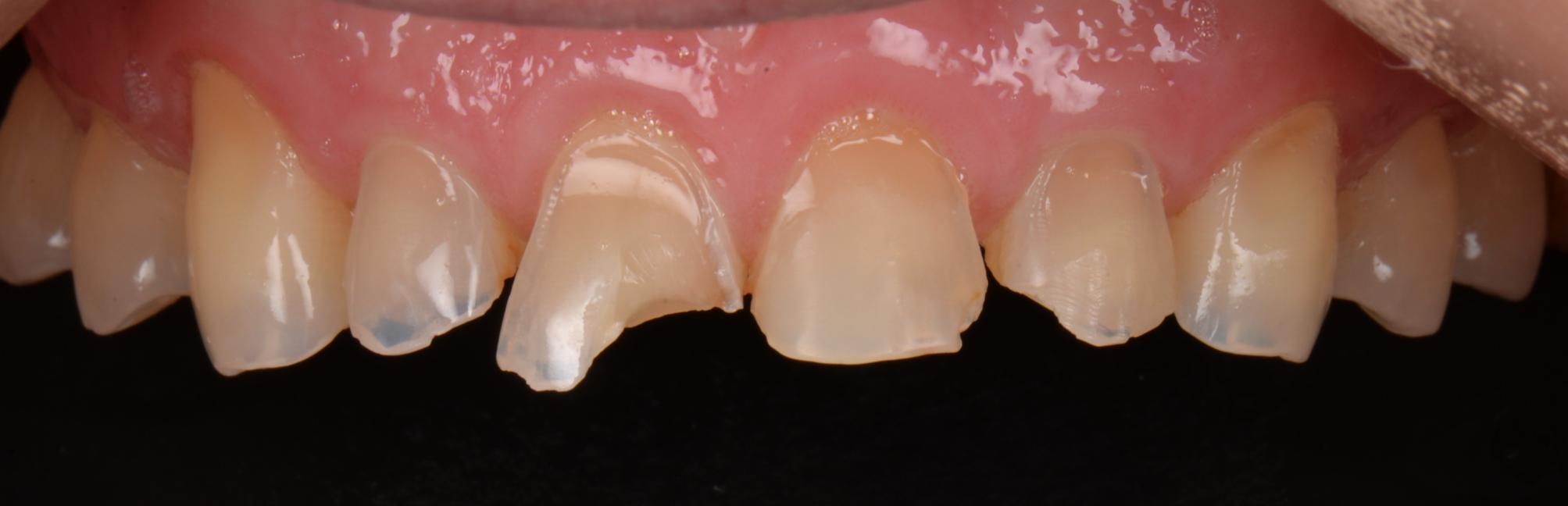 Clint - Close Up Transformation - Before