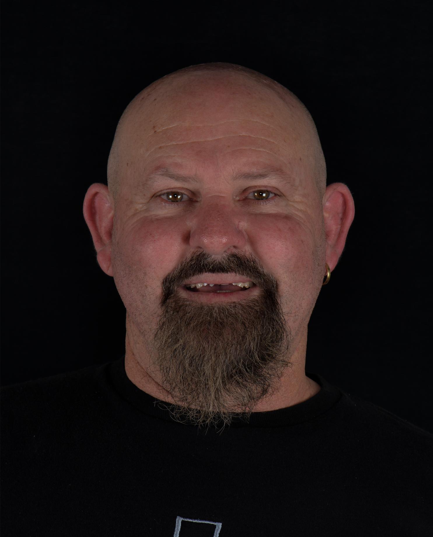 smile design - before & after - cosmetic dentist in adelaide - unley park dental